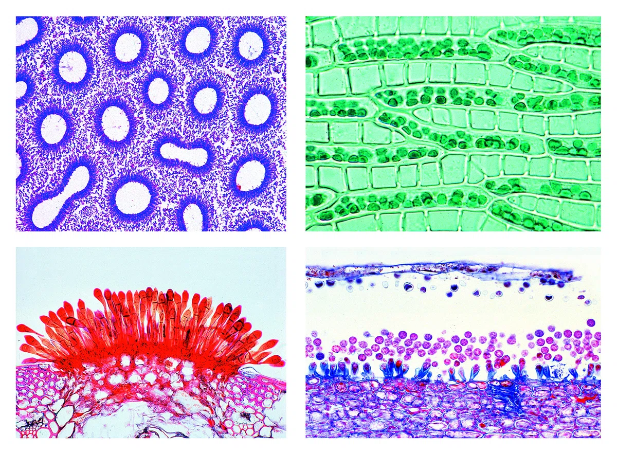 LIEDER Biologie Mikroskopie Mikropräparate Serien: Blütenlose Pflanzen (Cryptogamae), Ergänzungsserie I, 25 Präparate, Erweiterung der Serie 2600
